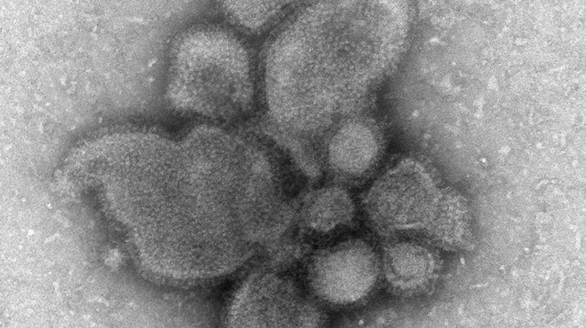 TEM image of influenza A H7N9, CDC