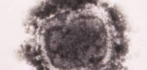 Virus in Found Tubes of Smallpox Is Viable