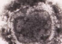 CDC-variola.jpg